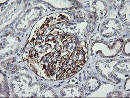 Immunohistochemical analysis of paraffin-embedded Human kidney tissue labeling VTI1A with ab156793 at 1/150 dilution.