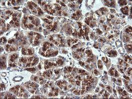Immunohistochemical analysis of paraffin-embedded Human pancreas tissue labeling VTI1A with ab156793 at 1/150 dilution.