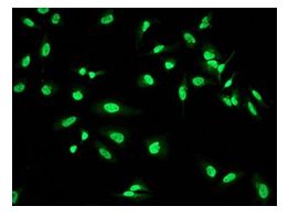 ab109537 at 1/100 dilution staining WAPL in HeLa cells by Immunofluorescence.