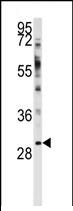 Anti-WBP2 antibody (ab76680) at 1/50 dilution + A2058 cell line lysate at 35 µg