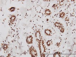 SMARCD2 antibody (ab58212) used in immunohistochemistry at 3ug/ml on formalin fixed and paraffin embedded human breast.