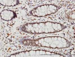 WDR20 antibody (ab57930) used in immunohistochemistry at 3ug/ml on formalin fixed and paraffin embedded human colon.