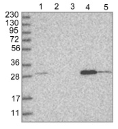 All lanes : Anti-WDR33 antibody (ab121899) at 1/250 dilutionLane 1 : RT 4 cell lysateLane 2 : U 251 MG cell lysateLane 3 : Human plasma lysateLane 4 : Human liver lysateLane 5 : Human tonsil lysate
