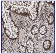 ab121899, at 1/45 dilution, staining WDR33 in paraffin embedded Human colon tissue by Immunohistochemistry.