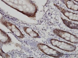 WDR4 antibody (ab56765) used in immunohistochemistry at 1ug/ml on formalin fixed and paraffin embedded human small Intestine.