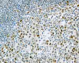 Immunohistochemical analysis of paraffin embedded Human tonsil tissue labeling WDR4 with ab169526 antibody at 1/250.