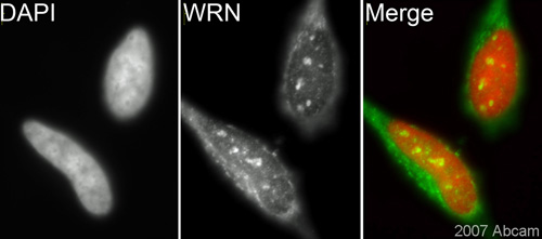 ab200 (1/1000) staining Werner's syndrome helicase WRN in HeLa cells (green). Cells were fixed in methanol, permeabilized with 0.5% Triton X100/ PBS and counterstained with DAPI in order to highlight the nucleus (red). Please refer to abreview for further experimental details.See Abreview