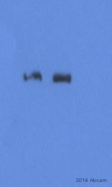 All lanes : Anti-Werner's syndrome helicase WRN antibody (ab17988) at 1/1000 dilutionLane 1 : Human Lymphocyte whole cell lysateLane 2 : Human Lymphocyte whole cell lysateLysates/proteins at 30 µg per lane.SecondaryAnti Rabbit IgG conjugated to HRP at 1/2000 dilutiondeveloped using the ECL techniquePerformed under reducing conditions.