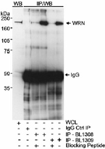 Detection of Human WRN by western blot and immunoprecipitation.Lane 1: 100 µg of whole cell lysate from 293T cells.Lane 2: 293T cell lysate immunoprecipated using IgG.Lane 3: 293T cell lysate immunoprecipitated using 5 µg of ab17987 + WRN blocking peptide.Lane 4: 293T cell lysate immunoprecipitated using 5 µg of ab17987.Lane 5: 293T cell lysate immunoprecipitated using 5 µg of ab17988 +WRN blocking peptide.Lane 6: 293T cell lysate immunoprecipitated using 5 µg of ab17988. Lanes 2-6 One 10 cm plate of 293T cells used for immunoprecipitation. Anti-WRN antibody (ab17988) used at 1/10,000 for western blot.Detection: Chemiluminescence with an exposure time of ~10 seconds.