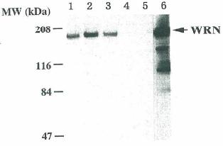 All lanes : Anti-Werner's syndrome helicase WRN antibody [4H12] (ab66606) at 1/500 dilutionLane 1 : Extracts from cells of normal individualsLane 2 : Extracts from cells of normal individualsLane 3 : Extracts from cells of normal individualsLane 4 : Extracts from cells of patients with Werner syndromeLane 5 : Extracts from cells of patients with Werner syndromeLane 6 : Purified recombinant WRN helicase made by baculovirus technology in the insect SF9 cells. See details published in the paper by Goto et al., Human Genet 105:301-307 (1999).