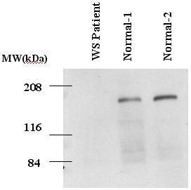 All lanes : Anti-Werner's syndrome helicase WRN antibody [4H12] (ab66606)Lane 1 : Werner syndrome patientLane 2 : Normal individualLane 3 : Normal individual