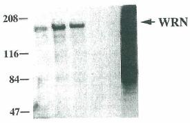 All lanes : Anti-Werner's syndrome helicase WRN antibody [8H3] (ab66601) at 1/500 dilutionLane 1 : Extracts from cells of normal individualsLane 2 : Extracts from cells of normal individualsLane 3 : Extracts from cells of normal individualsLane 4 : Extracts of cells from patients with Werner syndromeLane 5 : Extracts of cells from patients with Werner syndromeLane 6 : Purified recombinant WRN helicase made by baculovirus technology in the insect SF9 cells. See details published in the paper by Goto et al., Human Genet 105:301-307 (1999).