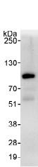 Detection of WHIP by Western Blot of Immunprecipitate. ab99316, at 1 µg/ml, staining WHIP in HeLa whole cell lysate immunoprecipitated using ab99316 at 3µg/mg lysate (1 mg/IP; 20% of IP loaded/lane). Detection: Chemiluminescence with exposure time of 30 seconds.