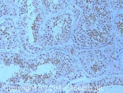 IHC image of WHSC1/NSD2 staining in human testis formalin fixed paraffin embedded tissue section, performed on a Leica BondTM system using the standard protocol F. The section was pre-treated using heat mediated antigen retrieval with sodium citrate buffer (pH6, epitope retrieval solution 1) for 20 mins. The section was then incubated with ab106180, 1µg/ml, for 15 mins at room temperature and detected using an HRP conjugated compact polymer system. DAB was used as the chromogen. The section was then counterstained with haematoxylin and mounted with DPX. For other IHC staining systems (automated and non-automated) customers should optimize variable parameters such as antigen retrieval conditions, primary antibody concentration and antibody incubation times.