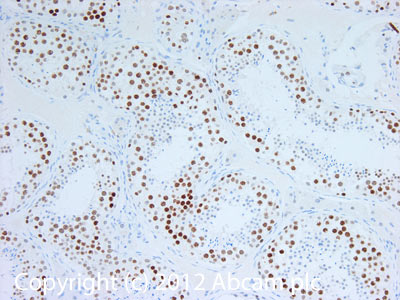 IHC image of WHSC1/NSD2 staining in Human normal testis formalin fixed paraffin embedded tissue section, performed on a Leica BondTM system using the standard protocol F. The section was pre-treated using heat mediated antigen retrieval with sodium citrate buffer (pH6, epitope retrieval solution 1) for 20 mins. The section was then incubated with ab75359, 5µg/ml, for 15 mins at room temperature and detected using an HRP conjugated compact polymer system. DAB was used as the chromogen. The section was then counterstained with haematoxylin and mounted with DPX.For other IHC staining systems (automated and non-automated) customers should optimize variable parameters such as antigen retrieval conditions, primary antibody concentration and antibody incubation times.