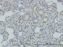 SMC1 antibody (ab56463) used in immunohistochemistry at 1ug/ml on formalin fixed and paraffin embedded human salivary gland.