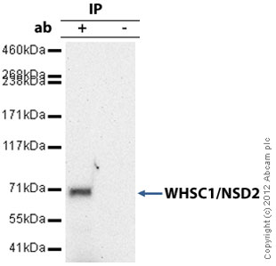 WHSC1/NSD2 was immunoprecipitated using 0.5mg HepG2 whole cell extract, 10µg of Mouse monoclonal to WHSC1/NSD2 and 50µl of protein G magnetic beads (+). No antibody was added to the control (-). The antibody was incubated under agitation with Protein G beads for 10min, HepG2 whole cell extract lysate diluted in RIPA buffer was added to each sample and incubated for a further 10min under agitation.Proteins were eluted by addition of 40µl SDS loading buffer and incubated for 10min at 70oC; 10µl of each sample was separated on a SDS PAGE gel, transferred to a nitrocellulose membrane, blocked with 5% BSA and probed with ab75359.Secondary: Goat polyclonal to mouse IgG light chain specific (HRP) at 1/5000 dilution.Band: 71kDa: WHSC1/NSD2.