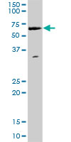 Anti-WHSC2 antibody (ab167675) at 1/500 dilution + HeLa cell nuclear extract at 50 µgdeveloped using the ECL technique
