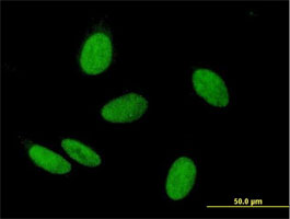 Immunofluorescence analysis of HeLa cells, labeling WHSC2 with ab167675 at 10 µg/ml.