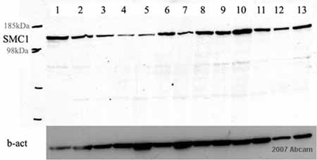 All lanes : Anti-SMC1 antibody [C2M] (ab16147) at 1/1000 dilutionLane 1 : Human BT-20 (breast cancer cell line) - whole cell lysateLane 2 : Human BT-474 (breast cancer cell line) - whole cell lysateLane 3 : Human HBL-100 (breast cancer cell line) - whole cell lysateLane 4 : Human HCC-1937 (breast cancer cell line) - whole cell lysateLane 5 : Human HME-1 (breast cancer cell line) - whole cell lysateLane 6 : Human Hs-578T (breast cancer cell line) - whole cell lysateLane 7 : Human MCF-10A (breast cancer cell line) - whole cell lysateLane 8 : Human MDA-MB 157(breast cancer cell line) - whole cell lysateLane 9 : Human MDA-MB 231 (breast cancer cell line) - whole cell lysateLane 10 : Human MDA-MB 436(breast cancer cell line) - whole cell lysateLane 11 : Human MDA-MB 453 (breast cancer cell line) - whole cell lysateLane 12 : Human MDA-MB 549 (breast cancer cell line) - whole cell lysateLane 13 : Human T47D (breast cancer cell line) - whole cell lysateLysates/proteins at 50 µg per lane.Second