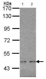 All lanes : Anti-Wilms Tumor Protein antibody (ab96792) at 1/1000 dilutionLane 1 : MOLT4 whole cell lysateLane 2 : Raji whole cell lysateLysates/proteins at 30 µg per lane.