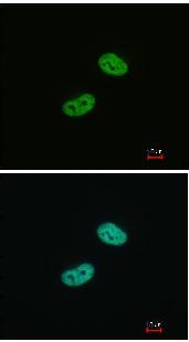 Immunofluorescence analysis of paraformaldehyde-fixed HeLa cells, using ab96792 at 1/200 dilution. Lower image is merged with DNA probe.