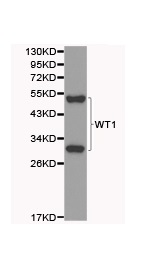 Anti-Wilms Tumor Protein antibody (ab180840) at 1/500 dilution + Human kidney cell lysate