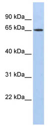 Anti-Wilms Tumor Protein antibody (ab86522) at 1 µg/ml + HepG2 cell lysate at 10 µgSecondaryanti-Rabbit IgG HRP at 1/50000 dilution