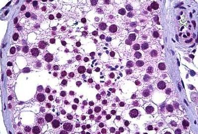 ab118873, at 10 µg/ml, staining Wilms Tumor Protein in formalin fixed, paraffin embedded Human testis tissue by Immunohistochemistry.