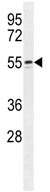 Anti-WIPF2 antibody (ab108132) at 1/100 dilution + 293 cell line lysate at 35 µg