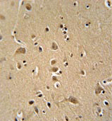 ab108132, at 1/50 dilution, staining WIPF2 in formalin-fixed, paraffin-embedded Human brain tissue by Immunohistochemistry using a peroxidase conjugated secondary antibody and DAB staining.
