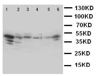 All lanes : Anti-WISP1 antibody - C-terminal (ab178547) at 0.5 µg/mlLane 1 : Rat heart tissue lysateLane 2 : Rat kidney tissue lysateLane 3 : Rat lung tissue lysateLane 4 : A549 cell lysateLane 5 : A431 cell lysateLane 6 : COLO320 cell lysate