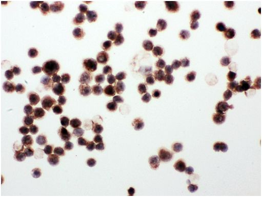 Immunocytochemical analysis of MCF7 cells labeling WISP1 with ab178547 at 1 µg/ml.