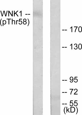 All lanes : Anti-WNK1 (phospho T58) antibody (ab53137) at 1/300 dilutionLane 1 : 293 cell extract treated with EGF (200ng/ml, 30mins)Lane 2 : 293 cell extract treated with EGF (200ng/ml, 30mins) with immunising peptide