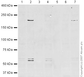 All lanes : Anti-WNK1 antibody (ab35069) at 1/250 dilutionLane 1 : HeLa (Human epithelial carcinoma cell line) Whole Cell LysateLane 2 : Jurkat (Human T cell lymphoblast-like cell line) Whole Cell Lysate (ab7899)Lane 3 : A431 (Human epithelial carcinoma cell line) Whole Cell Lysate (ab7909)Lane 4 : HEK293 (Human embryonic kidney cell line) Whole Cell Lysate (ab7902)Lane 5 : HepG2 (Human hepatocellular liver carcinoma cell line) Whole Cell Lysate (ab7900)Lane 6 : MCF7 (Human breast adenocarcinoma cell line) Whole Cell Lysate Lane 7 : SHSY-5Y (Human neuroblastoma cell line) Whole Cell Lysate Lysates/proteins at 10 µg per lane.SecondaryIRDye 680 Conjugated Goat Anti-Rabbit IgG (H+L) at 1/10000 dilutionPerformed under reducing conditions.
