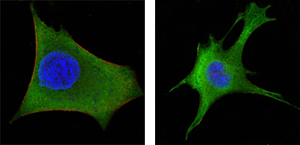 ab91191, staining Wnt1 in Hela (left) and 3T3L1 (right) cells by Confocal Immunofluorescence (green). Red: Actin filaments that have been labeled with DY-554 phalloidin. Blue: DRAQ5 fluorescent DNA dye.