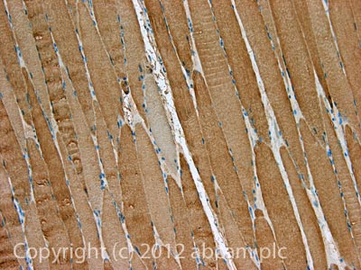 IHC image of Wnt1 staining in Human normal skeletal muscle formalin fixed paraffin embedded tissue section, performed on a Leica BondTM system using the standard protocol F. The section was pre-treated using heat mediated antigen retrieval with sodium citrate buffer (pH6, epitope retrieval solution 1) for 20 mins. The section was then incubated with ab91191, 5µg/ml, for 15 mins at room temperature and detected using an HRP conjugated compact polymer system. DAB was used as the chromogen. The section was then counterstained with haematoxylin and mounted with DPX.For other IHC staining systems (automated and non-automated) customers should optimize variable parameters such as antigen retrieval conditions, primary antibody concentration and antibody incubation times.
