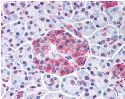 ab62051, at 10µg/ml, staining Wnt10a in Formalin Fixed Paraffin Embedded Human Pancreatic Islets tissue by Immunohistochemistry.