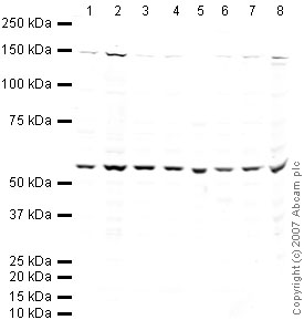 All lanes : Anti-Wnt6 antibody (ab50030) at 1 µg/mlLane 1 : HeLa (Human epithelial carcinoma cell line) Whole Cell LysateLane 2 : Jurkat (Human T cell lymphoblast-like cell line) Whole Cell LysateLane 3 : A431 (Human epithelial carcinoma cell line) Whole Cell LysateLane 4 : HEK293 Human embryonic kidney cell line Whole Cell LysateLane 5 : HepG2 (Human hepatocellular liver carcinoma cell line) Whole Cell LysateLane 6 : MCF7 (Human breast adenocarcinoma cell line) Whole Cell LysateLane 7 : SHSY-5Y (Human neuroblastoma cell line) Whole Cell LysateLane 8 : U2OS (Human osteosarcoma cell line) Whole Cell LysateLysates/proteins at 10 µg per lane.SecondaryIRDye 680 Conjugated Goat Anti-Rabbit IgG (H+L) at 1/10000 dilutionPerformed under reducing conditions.