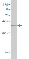 Western blot against tagged recombinant protein immunogen using ab57086 SMC1L2 antibody at 1ug/ml.