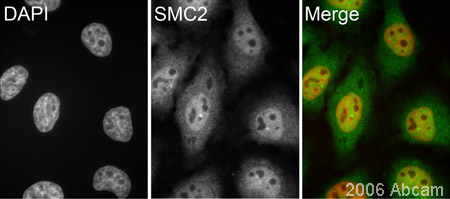  ab10412 (1/1000) staining SMC2 in assynchronous HeLa cells in conjunction with a secondary goat anti-rabbit antibody (1/200) conjugated to Cy3 ® (green). Cells were counterstained with DAPI to show the nucleus (red).See Abreview