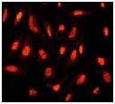Immunofluorescent staining of HeLa cells using ab51256 (1:100).