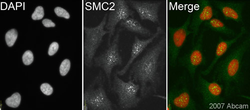 ab10399 (1/200) staining SMC2 in HeLa cells (green). Cells were fixed in methanol, permeabilised with 0.5% triton X-100/PBS and counterstained with DAPI in order to highlight the nucleus(red). Please refer to abreview for further experimental details.See Abreview
