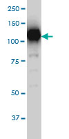 SIRT1 antibody (ab57090) at 1ug/lane + HeLa cell lysate at 25ug/lane.