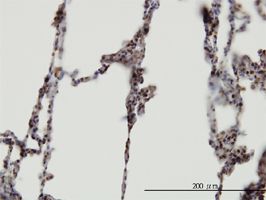 XAB2 antibody (ab57515) used in immunohistochemistry at 3ug/ml on formalin fixed and paraffin embedded human lung.