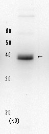 Anti-XPA antibody [5F12] (ab65963) at 0.1 µg/ml + Crude extract of HeLa cells at 200 µg