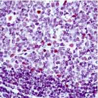 ab17798 XPF [SPM228] staining in formalin-fixed human tonsil tissue (1/50; 30min incubation at RT).