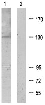 All lanes : Anti-XPG antibody (ab64931) at 1/500 dilutionLane 1 : Extracts from K562 cellsLane 2 : Extracts from K562 cells with immunising peptide at 10 µgLysates/proteins at 30 µg per lane.