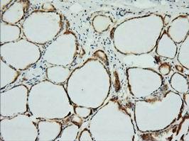ab123929 at 1/150 dilution staining XPNPEP1 in Paraffin-embedded Human Thyroid tissue by Immunohistochemistry.