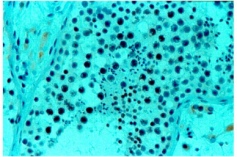 ab1838 - immunohistochemistry Formalin fixed paraffin embedded human testis stained with XRCC1, using ABC and AEC chromogen.